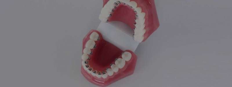 lingual-ortodonti-tedavisi-kucukcekmece