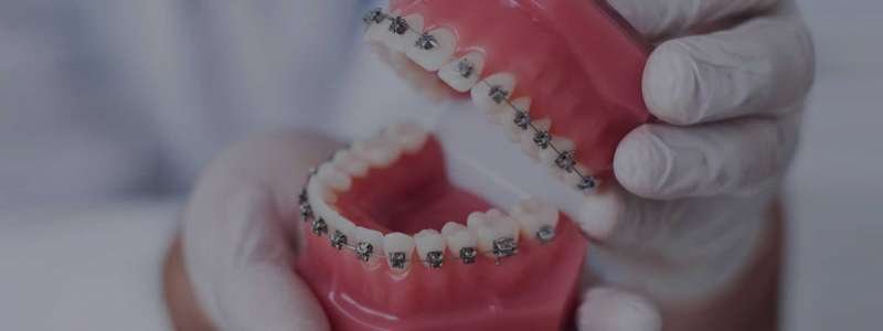 metal-dis-teli-ortodonti-tedavisi