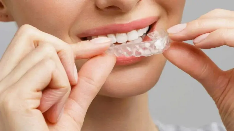 Ortodonti Nedir, Ortodonti Tedavisi Nasıl Uygulanır?